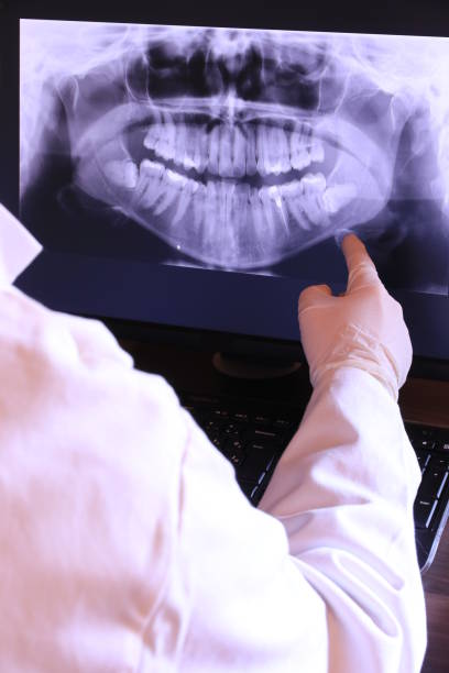 Best Emergency Root Canal Treatment in White House Station, NJ